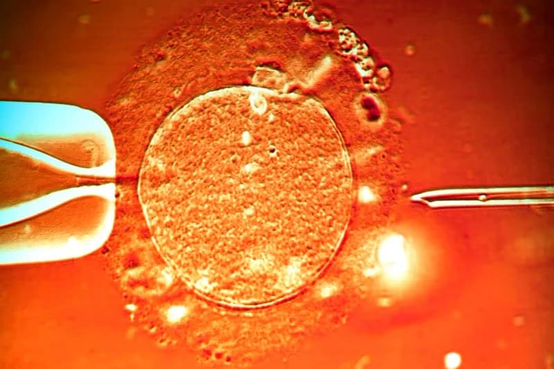Magnetic Sperm Enable Potential In-Body IVF with Fewer Invasive Steps