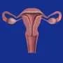 Îmbătrânirea uterină afectează succesul sarcinii după vârsta de 49 de ani, în ciuda utilizării ovocitelor donatate