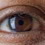 Cartografierea genetică oferă noi speranțe pentru detectarea timpurie a glaucomului