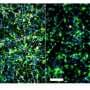 Inflammation Molecule TNF-alpha Found to Block New Neuron Growth