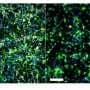Inflammation Molecule TNF-alpha Found to Block New Neuron Growth