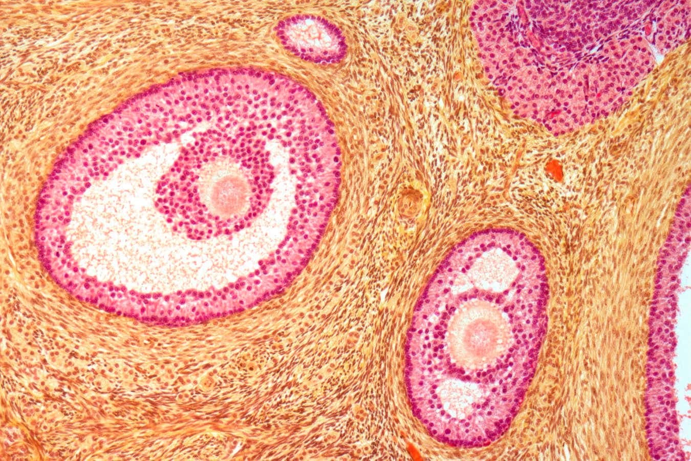 Ovary Softening Drug Could Significantly Extend Fertility Windows