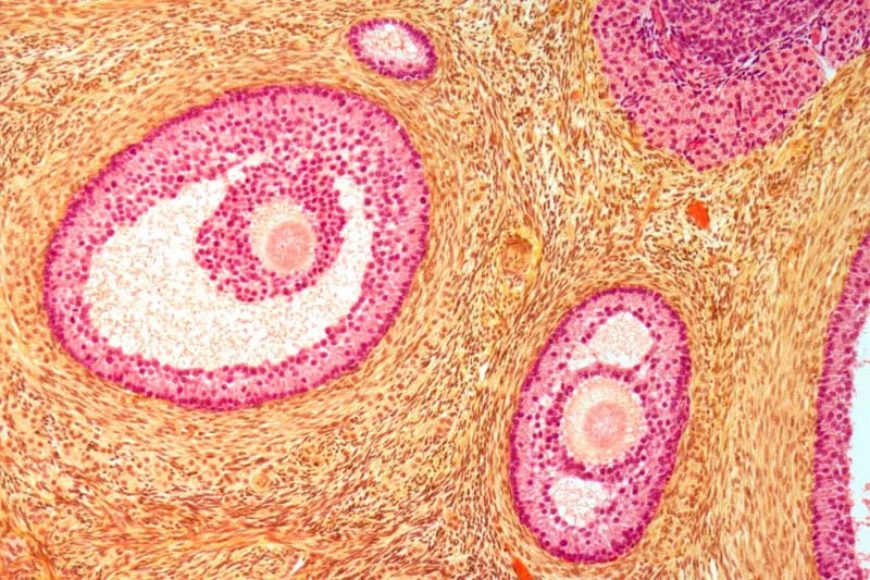 Un medicament pentru „întinerirea” ovarelor ar putea extinde semnificativ perioada de fertilitate
