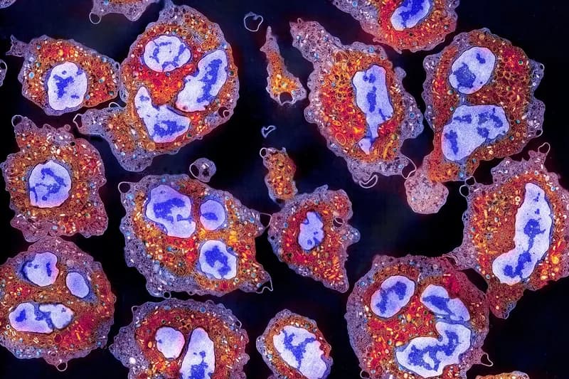 Restoring the Body's Ability to Clear 'Zombie Cells' May Prevent Cognitive Decline