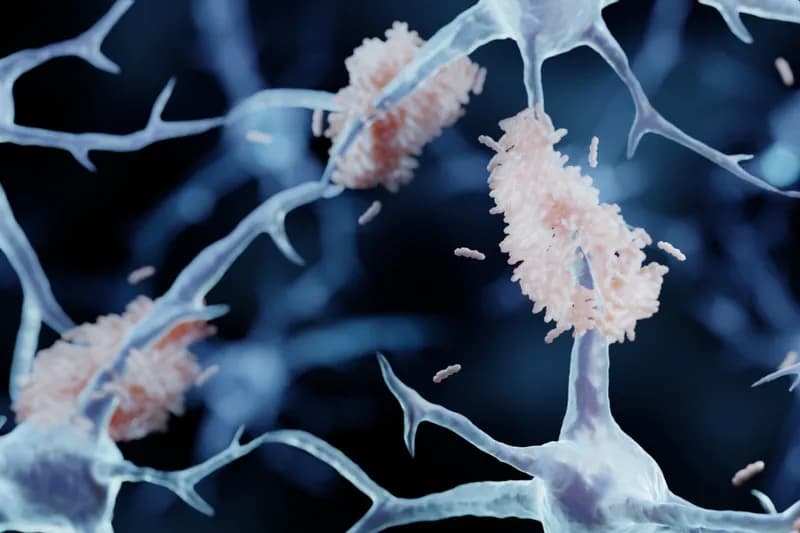 Banned Surgery: Thousands in China Undergo Risky Alzheimer's Procedure